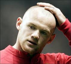 Wayne Rooney Bald.jpg